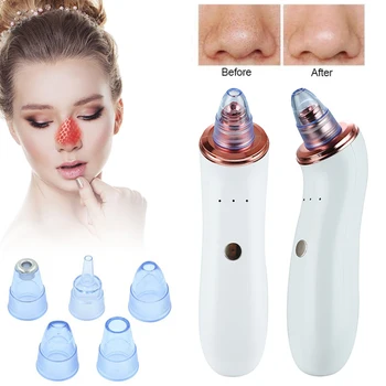 Microcurrent Vacuum Pore Cleaner Blackhead Electric Acne Cleansing Face Facial Instrument Comedones Remover Face Skin Care Tools
Microcurrent Vacuum Pore Cleaner Blackhead Electric Acne Cleansing Face Facial Instrument Comedones Remover Face Skin Care Tools