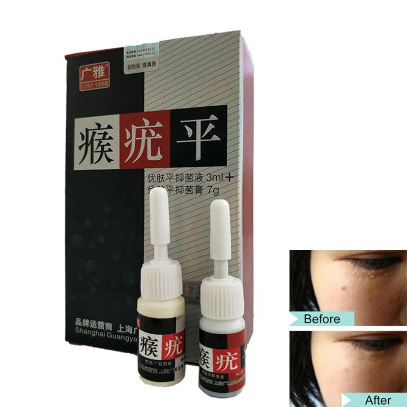 Skin Tag Warts Removal Liquid Cream Set Body Corn Removal All Natural Skin Care SK88
Skin Tag Warts Removal Liquid Cream Set Body Corn Removal All Natural Skin Care SK88