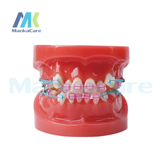Manka Care -24 шт. зубьев, все керамические кронштейны, модель зубьев для полости рта
Manka Care -24 шт. зубьев, все керамические кронштейны, модель зубьев для полости рта
