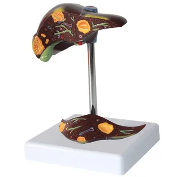 Liver Pathology Model Fatty Liver Demonstration Cirrhosis Liver Carcinoma Model Gallstone Hepatobiliary Disease Model Medical
Liver Pathology Model Fatty Liver Demonstration Cirrhosis Liver Carcinoma Model Gallstone Hepatobiliary Disease Model Medical