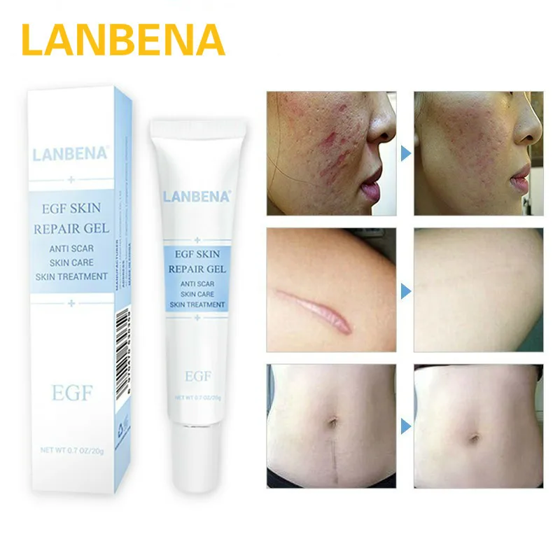 LANBENA Acne Scar Removal cream epidermal growth factor Neutral Ointment Skin Care face cream Whitening anti aging moisturizer
LANBENA Acne Scar Removal cream epidermal growth factor Neutral Ointment Skin Care face cream Whitening anti aging moisturizer