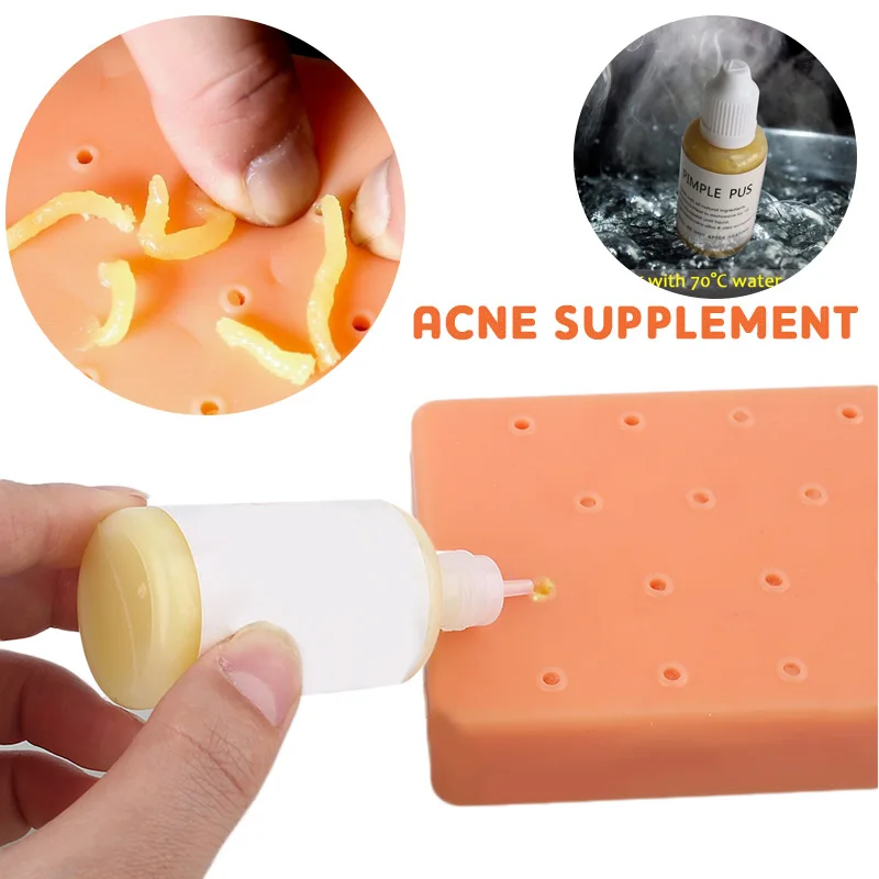 Squeezing Acne Liquid Replenisher Additive Toys Liquid Props 1pcs Toy Gags Stress Reliever Toys Popper Remover Funny
Squeezing Acne Liquid Replenisher Additive Toys Liquid Props 1pcs Toy Gags Stress Reliever Toys Popper Remover Funny