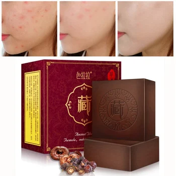 Natural Herbal Pimple Pores Blackhead Removal Treatment Oil Control Moisturizing Face Body Beauty Wash Soap 100g
Natural Herbal Pimple Pores Blackhead Removal Treatment Oil Control Moisturizing Face Body Beauty Wash Soap 100g