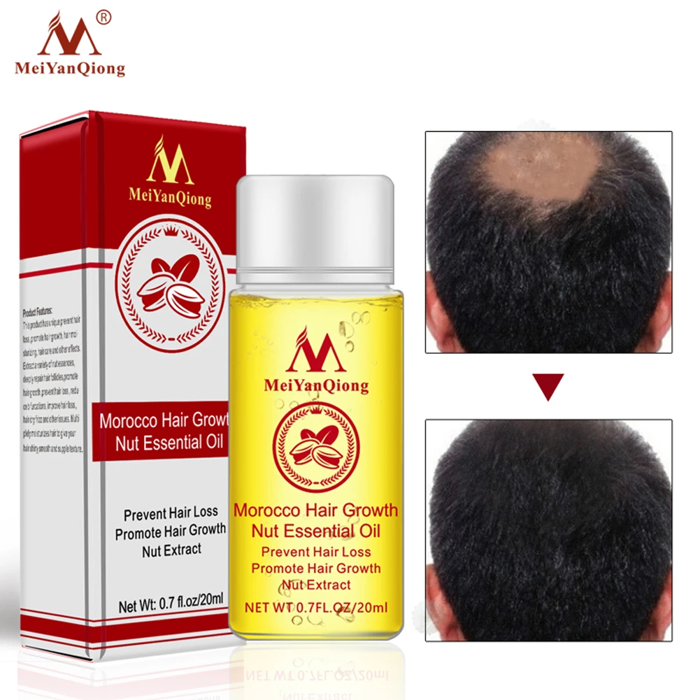 20ml Nuts Natural Protects Damaged Hair Essential Oil Fragrance Preventing Hair Loss Hair Growth For Dry Hair Care
20ml Nuts Natural Protects Damaged Hair Essential Oil Fragrance Preventing Hair Loss Hair Growth For Dry Hair Care