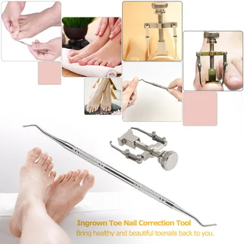 Foot Care Ingrown Toenail Correction Lifter File Set Stainless Steel Ingrown Toenails Fixer Lifter Nail File Clean Pedicure Tool
Foot Care Ingrown Toenail Correction Lifter File Set Stainless Steel Ingrown Toenails Fixer Lifter Nail File Clean Pedicure Tool