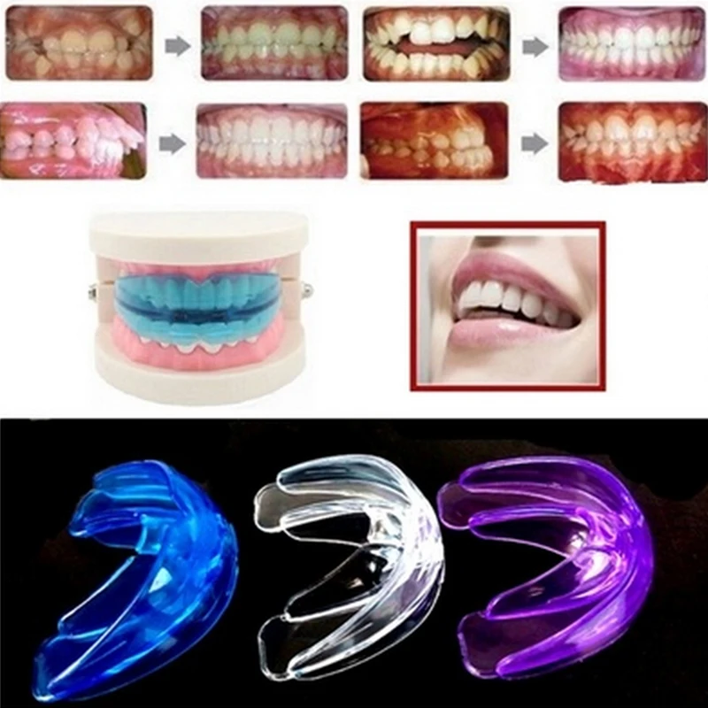 Mouth Teeth Dental Oral Orthodontic Appliance Trainer Tooth Correction Buck Braces Teeth Retainer Keep Uou Beautiful Corrector
Mouth Teeth Dental Oral Orthodontic Appliance Trainer Tooth Correction Buck Braces Teeth Retainer Keep Uou Beautiful Corrector