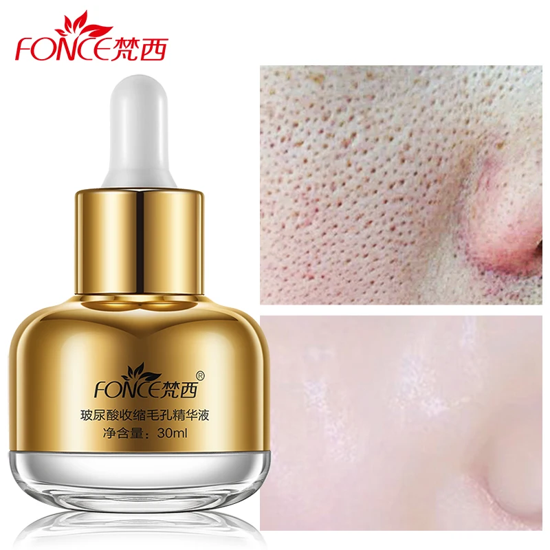 Fonce Shrink pores Liquid Hyaluronic acid Moisturizing Anti Aging Face Serum Repair Remove Blackhead essential oils Essence
Fonce Shrink pores Liquid Hyaluronic acid Moisturizing Anti Aging Face Serum Repair Remove Blackhead essential oils Essence