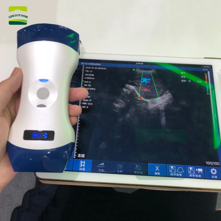Vet PW color Double probe Wireless Veterinary Ultrasound Scanner Portable Pregnancy Test pig dog Hand Ultrasound Pocket dog
Vet PW color Double probe Wireless Veterinary Ultrasound Scanner Portable Pregnancy Test pig dog Hand Ultrasound Pocket dog