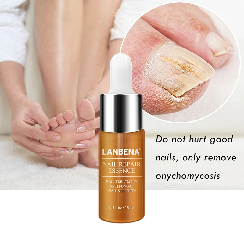 LANBENA 50 Nail Repair Essence Serum Fungal Nail Treatment Remove Onychomycosis Toe Nail Nourishing Brightening Hand Foot Care
LANBENA 50 Nail Repair Essence Serum Fungal Nail Treatment Remove Onychomycosis Toe Nail Nourishing Brightening Hand Foot Care