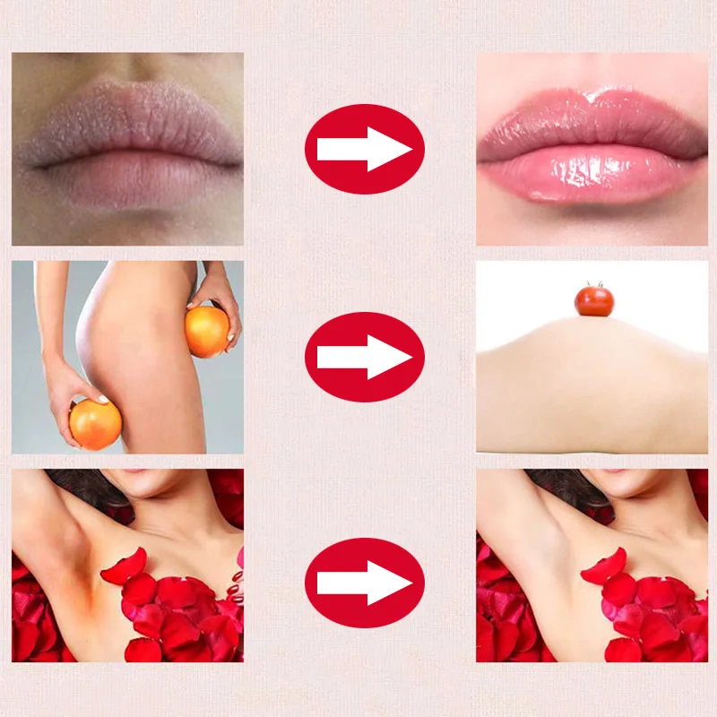 High Quality Whitening Cream Lip Private Part Dark Nipple Bleaching Vaginal Fresh Up Moisturizing long-lasting Beauty Makeup
High Quality Whitening Cream Lip Private Part Dark Nipple Bleaching Vaginal Fresh Up Moisturizing long-lasting Beauty Makeup