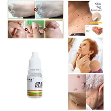 Body Warts Treatment Cream Skin Tag Remover Foot Corn Removal Plantar Genital Warts Ointment Foot Care Cream 10ML
Body Warts Treatment Cream Skin Tag Remover Foot Corn Removal Plantar Genital Warts Ointment Foot Care Cream 10ML