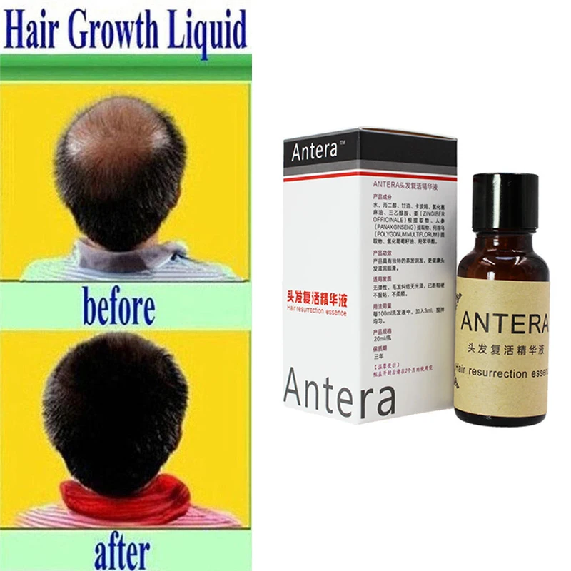 1 bottle Hair Growth Essence Hair Loss Liquid Natural Pure Origina Essential Oil Fast Hair Growth Extension Health Care Beauty
1 bottle Hair Growth Essence Hair Loss Liquid Natural Pure Origina Essential Oil Fast Hair Growth Extension Health Care Beauty