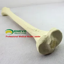 Simulation of artificial bone in the Department of orthopedics of the Sawbone artificial bone model Department of orthopedics
Simulation of artificial bone in the Department of orthopedics of the Sawbone artificial bone model Department of orthopedics