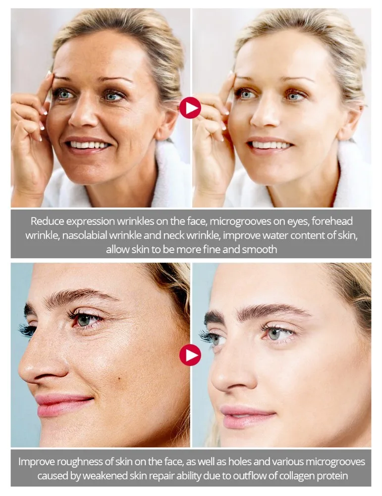 30ml Six Peptides Face Cream Argireline Pure Collagen Cream Anti-wrinkle Firming Anti Aging Acne Whitening Moisturizing Cream 15
