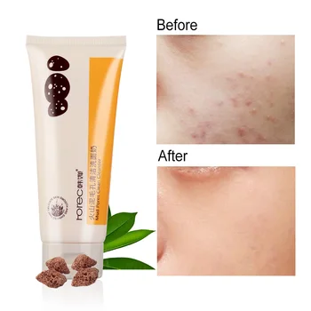 1 Pcs Pore Terminator Cleansing Foam Face Cleaner Volcanic Mud Cleanser Oil Control Moisturizing Whitening Beauty Care Tool
1 Pcs Pore Terminator Cleansing Foam Face Cleaner Volcanic Mud Cleanser Oil Control Moisturizing Whitening Beauty Care Tool