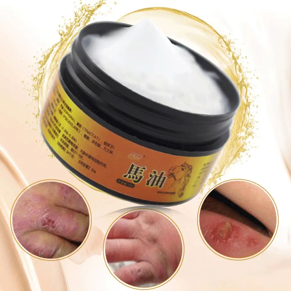 1pc Horse Oil Powerful Frozen Cracking Cream Prevent Repair Skin Dry Chapped Frozen Frostbite Anti Dry Crack Medicinal Ointment
1pc Horse Oil Powerful Frozen Cracking Cream Prevent Repair Skin Dry Chapped Frozen Frostbite Anti Dry Crack Medicinal Ointment