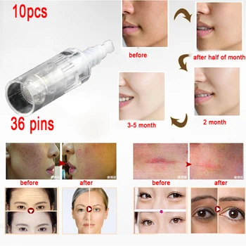 Mezoroller 10PCS Electric Derma Pen Needles Bayonet 36 pin MYM Cartridge For Auto Microneedle Derma Pen Tattoo Needles Tips
Mezoroller 10PCS Electric Derma Pen Needles Bayonet 36 pin MYM Cartridge For Auto Microneedle Derma Pen Tattoo Needles Tips