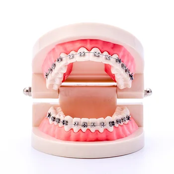 dental preparation teeth model teaching planting model communication pathology detachable orthodontic model
dental preparation teeth model teaching planting model communication pathology detachable orthodontic model