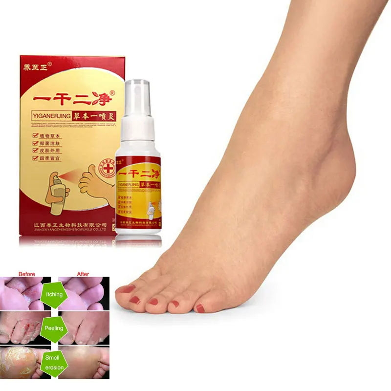 30ml/bottle Natural Foot Spray Eczema Psoriasis Rosacea Pruritus Skin Chinese Herbal Feet Spray
30ml/bottle Natural Foot Spray Eczema Psoriasis Rosacea Pruritus Skin Chinese Herbal Feet Spray