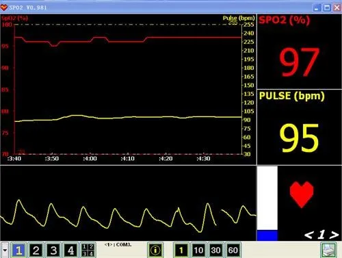 24 hours Recorder,Finger Pulse Oximeter,Blood OxygenPLUSBlood Oxygen Saturation saturometre pulsoximeter oximetro de dedo blood
24 hours Recorder,Finger Pulse Oximeter,Blood OxygenPLUSBlood Oxygen Saturation saturometre pulsoximeter oximetro de dedo blood
