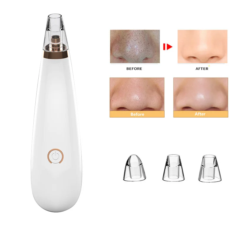 Blackhead Remover Vacuum -Upgraded USB Rechargeable Pore Vacuum Cleaner Blackhead Extractor Tool Device Comedo Removal Suction
Blackhead Remover Vacuum -Upgraded USB Rechargeable Pore Vacuum Cleaner Blackhead Extractor Tool Device Comedo Removal Suction