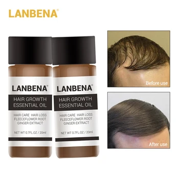 20ml 2PCS LANBENA Hair Growth Essence Hair Growth Products Essential Oil Liquid Treatment Preventing Hair Loss Hair Care Andrea
20ml 2PCS LANBENA Hair Growth Essence Hair Growth Products Essential Oil Liquid Treatment Preventing Hair Loss Hair Care Andrea