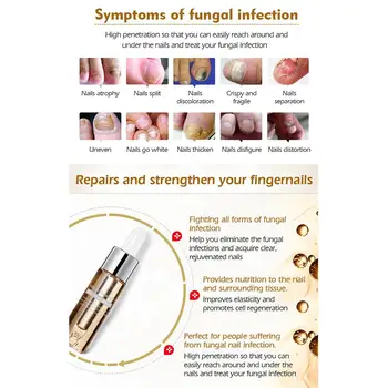 VIBRANT GLAMOUR Nail Repair Solution Anti Fungus Onychomycosis Repair Crack Nail Toe Care Essential Liquid
VIBRANT GLAMOUR Nail Repair Solution Anti Fungus Onychomycosis Repair Crack Nail Toe Care Essential Liquid