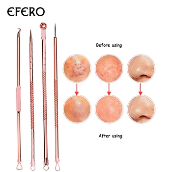 4Pcs/Set Rose Gold Acne Needle Blackhead Removal Needles Pimple Spot Comedone Extractor Cleanser Beauty Face Care Clean Tools
4Pcs/Set Rose Gold Acne Needle Blackhead Removal Needles Pimple Spot Comedone Extractor Cleanser Beauty Face Care Clean Tools