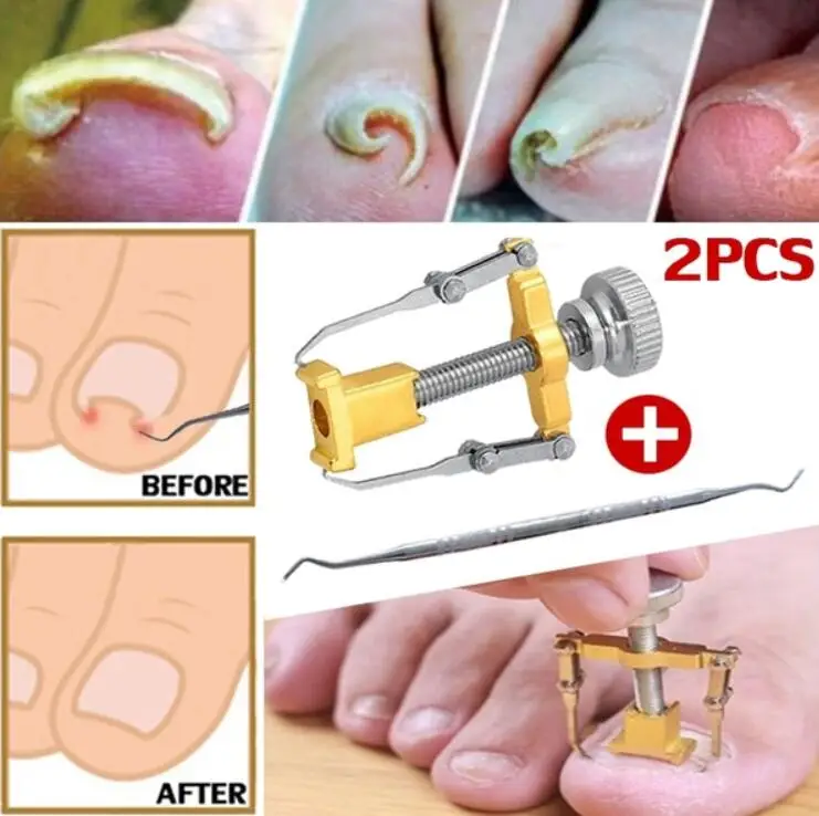Foot Care Tool Toe Nails Clippers Ingrown Nail Nippers Cutters Foot File Dead Skin Dirt Remover + Paronychia Podiatry Pedicure
Foot Care Tool Toe Nails Clippers Ingrown Nail Nippers Cutters Foot File Dead Skin Dirt Remover + Paronychia Podiatry Pedicure