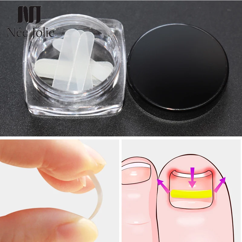 10pcs/Box Ingrown Nail Correction Toe Sticker Patch Correction File Corrector Foot Care Professional Nail Tool For Nail Art
10pcs/Box Ingrown Nail Correction Toe Sticker Patch Correction File Corrector Foot Care Professional Nail Tool For Nail Art