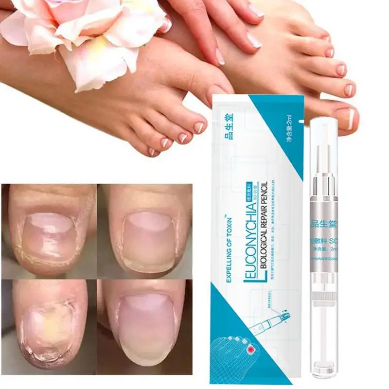 3ml Nail Fungus Treatment Rehydration Solution Liquid Anti Fungal Finger Toe Nails Care Restore Normal Nail Glossy New arrivals
3ml Nail Fungus Treatment Rehydration Solution Liquid Anti Fungal Finger Toe Nails Care Restore Normal Nail Glossy New arrivals