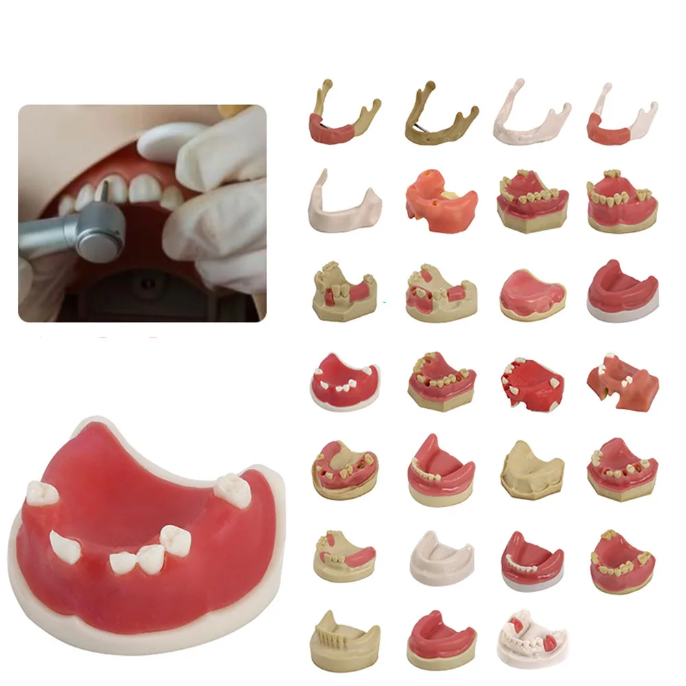 Dental materials dental model oral implant surgery maxillary sinus dental supplies equipment tools soft gums
Dental materials dental model oral implant surgery maxillary sinus dental supplies equipment tools soft gums