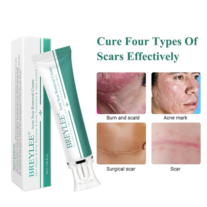 Acne Scar Removal Cream 30g Face Cream Skin Repair Skin Care Scar Acne Treatment Remove Stretch Marks Whitening Cream
Acne Scar Removal Cream 30g Face Cream Skin Repair Skin Care Scar Acne Treatment Remove Stretch Marks Whitening Cream