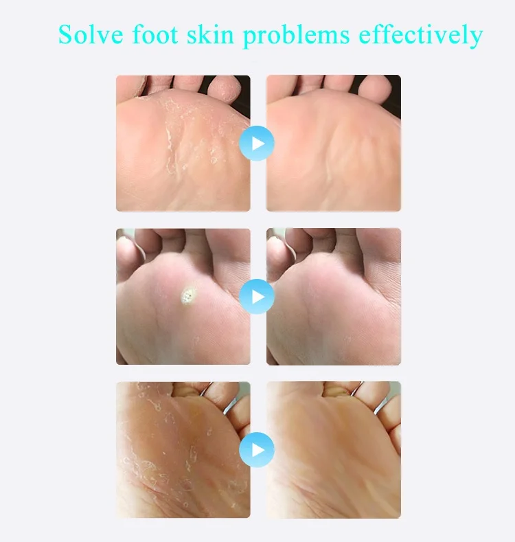 Pedicure-Tools-Foot-Care-File-for-Feet-Heels-Toe-Cuticle-Kit-Professional-Scholl-File-Pedicure-Set-Beauty-Products-Pusher-Remover-2018-new- (10)