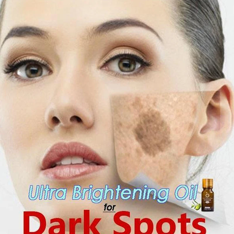 New Ultra Brightening Spotless Oil Skin Care Natural Pure Remove Ance Burn Strentch Marks Scar Removal dark spots killer
New Ultra Brightening Spotless Oil Skin Care Natural Pure Remove Ance Burn Strentch Marks Scar Removal dark spots killer