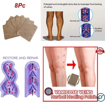 8Pc Varicose Veins Herbal Healing Patch Varicose Veins Cure Patch Plasters Joint Pain Relieve Medical Patch Rheumatoid
8Pc Varicose Veins Herbal Healing Patch Varicose Veins Cure Patch Plasters Joint Pain Relieve Medical Patch Rheumatoid