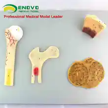 Bone structure model of vascular cancellous bone compact bone and femoral hip system human skeleton
Bone structure model of vascular cancellous bone compact bone and femoral hip system human skeleton