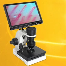 Electronic Microcirculation Detector Peripheral Vessel of Nail Wall Observer Digital Microscope with 7"/8"/9" LCD Displayer
Electronic Microcirculation Detector Peripheral Vessel of Nail Wall Observer Digital Microscope with 7"/8"/9" LCD Displayer