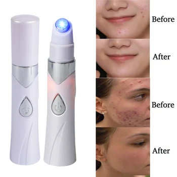 New Acne Laser Pen Portable Wrinkle Removal MachineMedical Blue Light Facial Massager Scar Wrinkle Acne Removal USB charging
New Acne Laser Pen Portable Wrinkle Removal MachineMedical Blue Light Facial Massager Scar Wrinkle Acne Removal USB charging