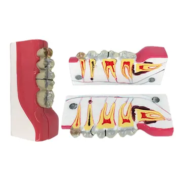 Lower Right Posterior Teeth Tissue Decomposition Model Human Medical Model School Teaching Tool Learning Display Lab Supplies
Lower Right Posterior Teeth Tissue Decomposition Model Human Medical Model School Teaching Tool Learning Display Lab Supplies