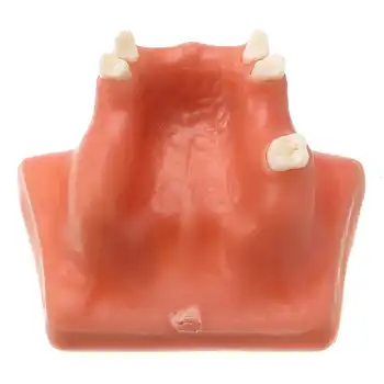 Maxillary Teeth Model Upper Jaw Sinus Lift Implants Restoration Dental Practice Model For Medical Teach Study Demostration
Maxillary Teeth Model Upper Jaw Sinus Lift Implants Restoration Dental Practice Model For Medical Teach Study Demostration