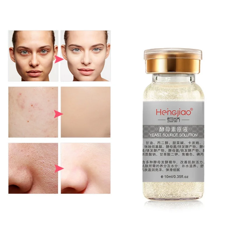 Face Cream Yeast Moistening Essence Whitening Serum Remove Acne Anti Wrinkle For Face Skin Care Blemish Facial Cream 10ml
Face Cream Yeast Moistening Essence Whitening Serum Remove Acne Anti Wrinkle For Face Skin Care Blemish Facial Cream 10ml