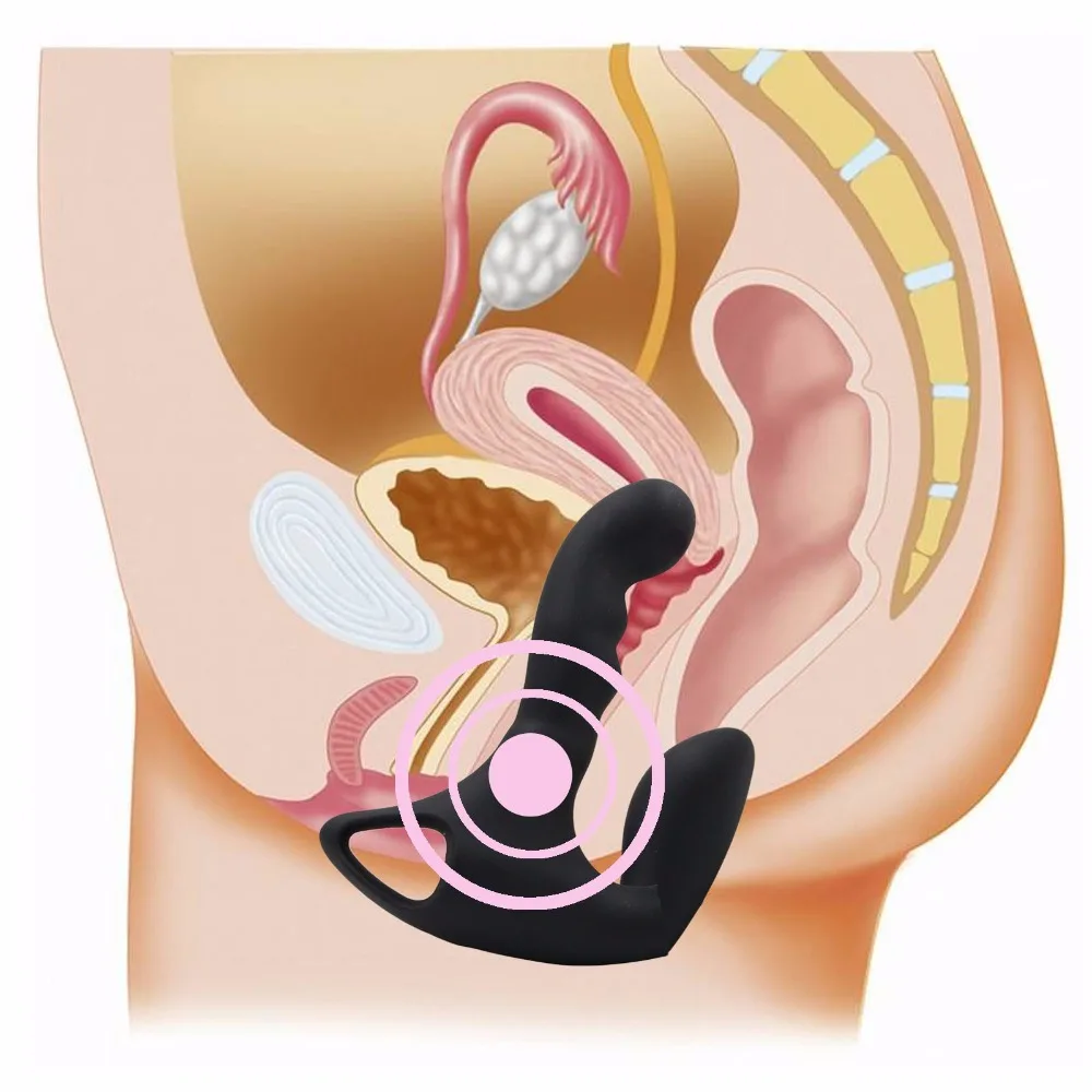 Ring-pull Double Anal Vagina Vibrators for Women Protate G Spot Vibrator Sex Toys for Women Men Erotic Toys for Adults