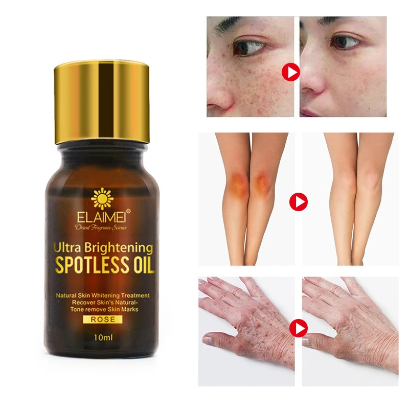 High Quality Natural Plant Extracts Skin Care Dark Spots Remove Ance Antioxidants Essential Fatty Acids for Skin Tone TSLM1
High Quality Natural Plant Extracts Skin Care Dark Spots Remove Ance Antioxidants Essential Fatty Acids for Skin Tone TSLM1