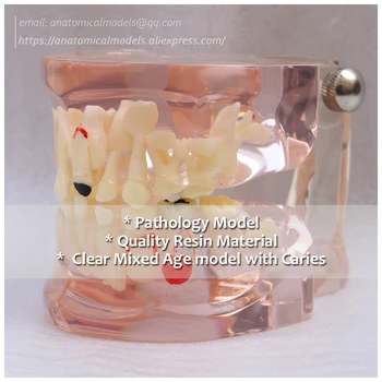 DH/13063, Transparent Missing Deciduous Teeth Model, Dental, Medical Science Educational Teaching Anatomical Models
DH/13063, Transparent Missing Deciduous Teeth Model, Dental, Medical Science Educational Teaching Anatomical Models