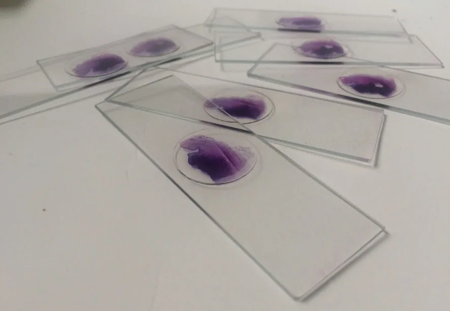 pathology slides (1)
