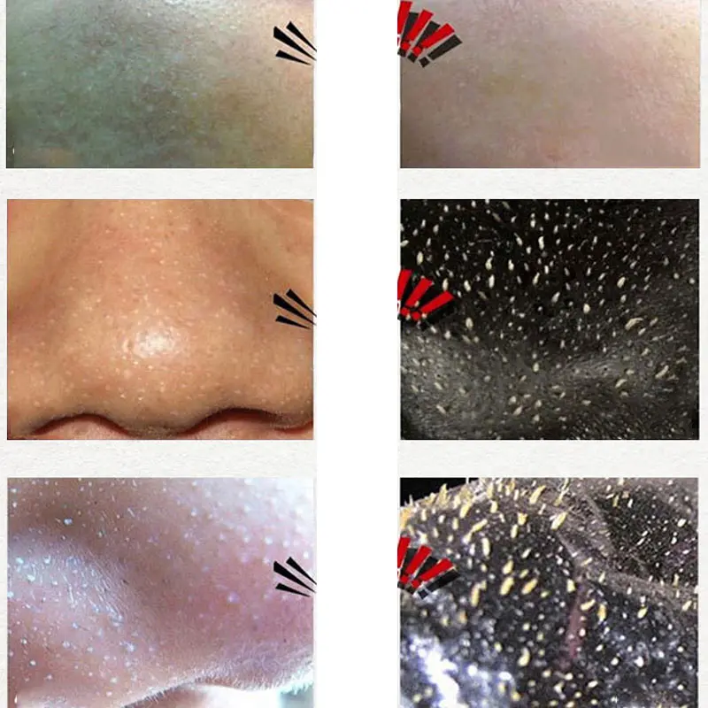 10pcs Blackhead Removal Mask Nasal Membrane Cream Mask Anti Acne Oil Control HS11
10pcs Blackhead Removal Mask Nasal Membrane Cream Mask Anti Acne Oil Control HS11