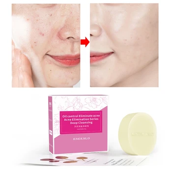 2019 Natural Sea Salt Soap Cleaner Removal Pimple Pores Acne Treatment Moisturizing Face Care Wash Soap Long Lasting
2019 Natural Sea Salt Soap Cleaner Removal Pimple Pores Acne Treatment Moisturizing Face Care Wash Soap Long Lasting