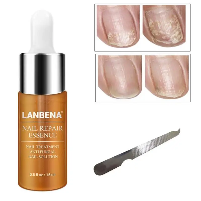 15ML Nail Repair Essence Serum Fungal Nail Treatment Remove Onychomycosis Hands Feet Care of Toe Nail Nourishing Brighten
15ML Nail Repair Essence Serum Fungal Nail Treatment Remove Onychomycosis Hands Feet Care of Toe Nail Nourishing Brighten