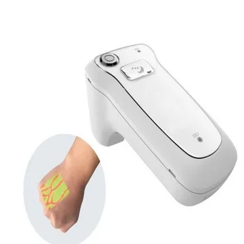 Portable projection near-infrared vascular imaging light puncture-assisted high-definition venous blood vessel display
Portable projection near-infrared vascular imaging light puncture-assisted high-definition venous blood vessel display
